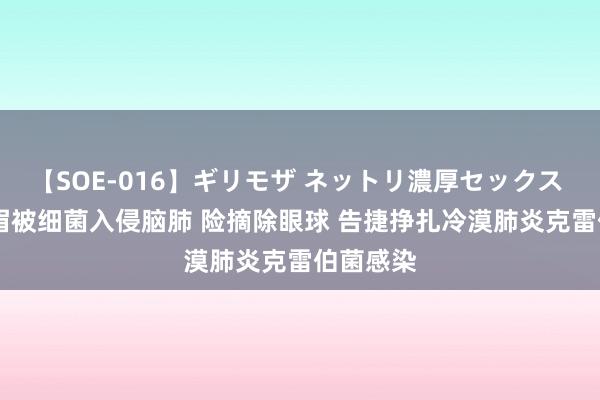 【SOE-016】ギリモザ ネットリ濃厚セックス Ami 须眉被细菌入侵脑肺 险摘除眼球 告捷挣扎冷漠肺炎克雷伯菌感染